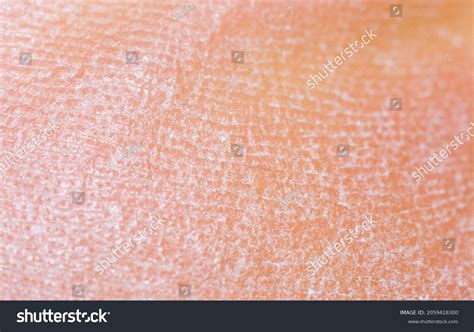 Skin Texture Pattern Background Stock Photo 2059418300 | Shutterstock