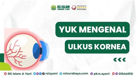 Ulkus Kornea Rs Islam Surabaya A Yani Youtube