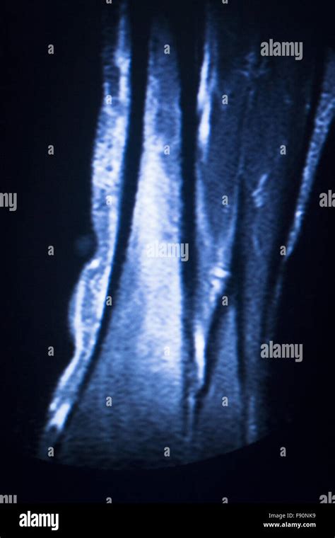 Mrt Magnet Resonanz Tomographie Medizinischen Test Scanergebnisse Mit