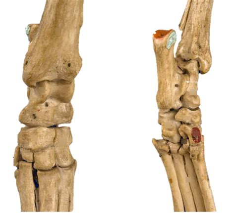 Osteology Canine Tarsus Diagram Quizlet