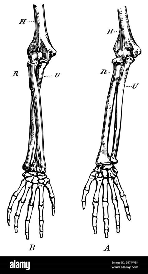 This diagram shows the bones of the right fore-arm, vintage line ...