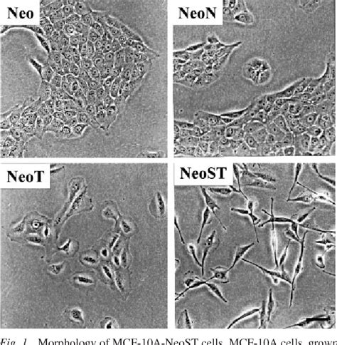 Figure 1 from MCF-10 A-NeoST : A New Cell System for Studying Cell-ECM and Cell-Cell ...