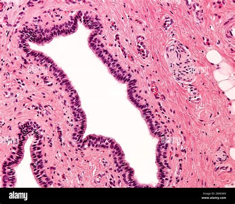 Stratified columnar epithelium. It is a rare type of epithelium composed of columnar cells ...