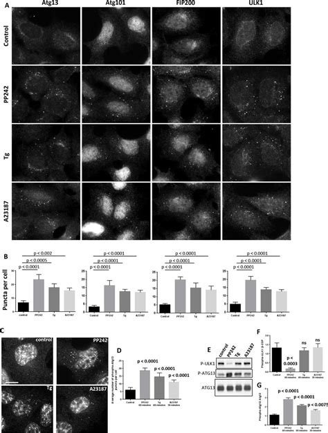 Phospho Ulk1 Cell Signaling Technology Inc Bioz