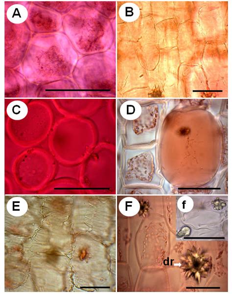 The chlorenchyma. A, in surface view; B, in lateral view; A, B, both ...