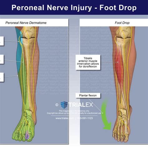 Plantar Anatomy of the Foot - Trial Exhibits Inc.