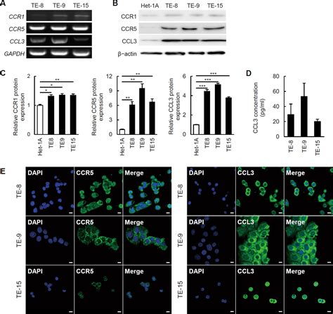 Ccl3 Ccr5 Axis Contributes To Progression Of Esophageal Squamous Cell