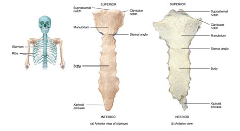 Costal Notch