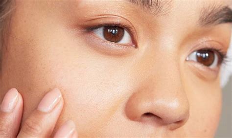 7 Surprising Causes Of Acne