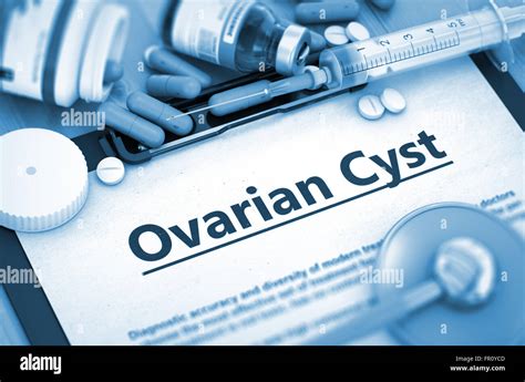 Le Diagnostic Dun Kyste Ovarien Concept Médical Photo Stock Alamy