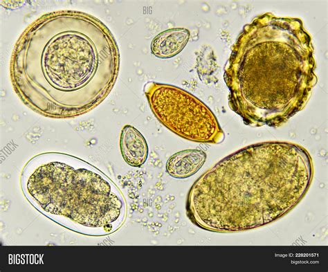 Mixed Helminths Stool Image & Photo (Free Trial) | Bigstock