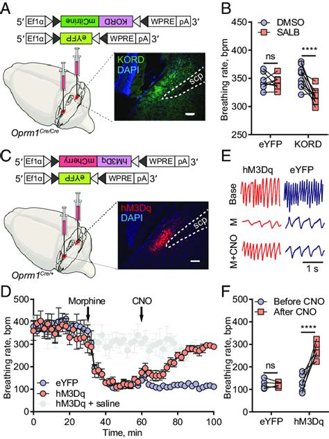 Inhibition Of PBL Oprm1 Neurons Mimics OIRD And Chemogenetic