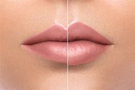 What Causes Swollen Lips From Kissing Lipstutorial Org