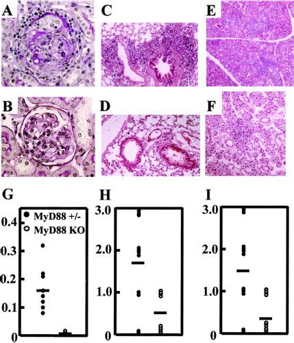 Protection Against Autoimmune Nephritis In Myd Deficient Mrl Lpr Mice