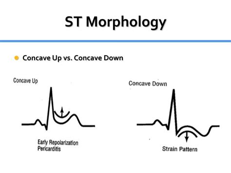 Ppt St Elevation Powerpoint Presentation Free Download Id2052823