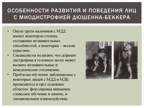 Миодистрофия Дюшенна-Беккера - презентация онлайн