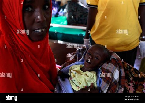 Child Africa Malnutrition Hi Res Stock Photography And Images Alamy