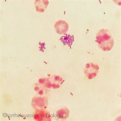 Gram Positive Rods In Csf