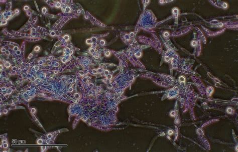 Qué es el Pythium Alchimia Grow Shop