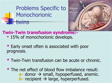 PPT - Multiple Fetal Pregnancy PowerPoint Presentation, free download ...