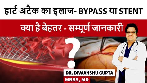 Stent Or Bypass क्या है बेहतर Stent Vs Bypass Surgery Bypass Or Angioplasty Which Is Better