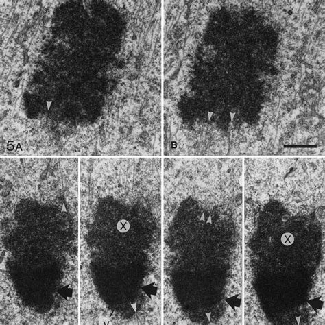 Electron Micrographs Of Two Consecutive Serial Sections Through An