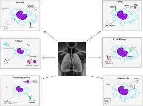 Pulmonary Macrophages Key Players In The Innate Defence Of The Airways