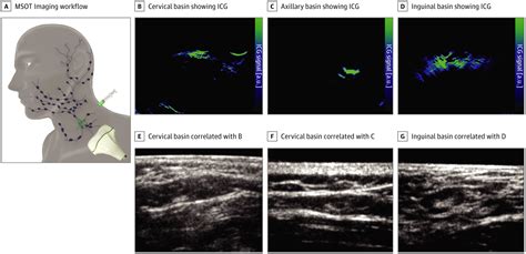 Assessment Of Nonradioactive Multispectral Optoacoustic Tomographic Imaging With Conventional