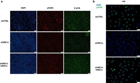 The Endoplasmic Reticulum Stress Sensor IRE1α Regulates the UV DNA