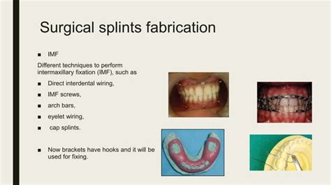 Surgery First Orthognathic Approach Ppt