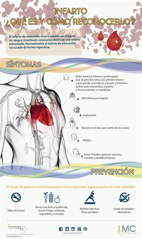 Infarto qué es y como reconocerlo Prevencionar