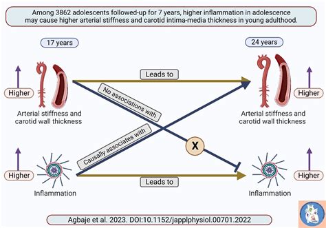 Low Grade Inflammation May Cause Arterial Stiffness And Preclinical Atherosclerosis In Otherwise