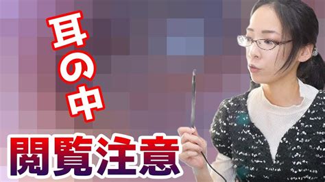 【閲覧注意】耳かきしすぎて耳の中がとんでもないことに耳カメラ買いました Youtube