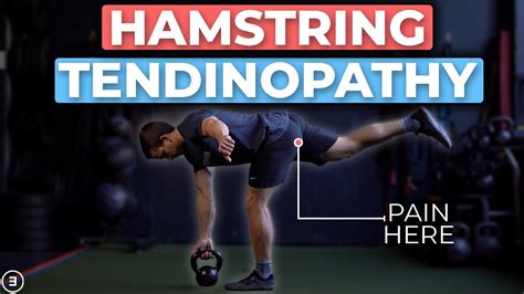 Eccentric Hamstring Exercises Pdf | EOUA Blog