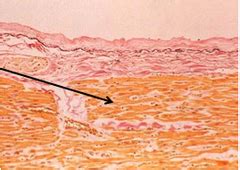 Histology Circulatory System Pictures Flashcards | Quizlet