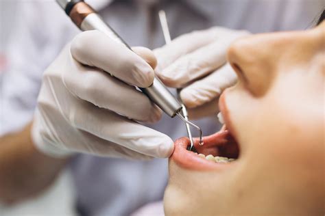 Odontología Torremolinos 2022 Málaga Clínicas Rincón Dental