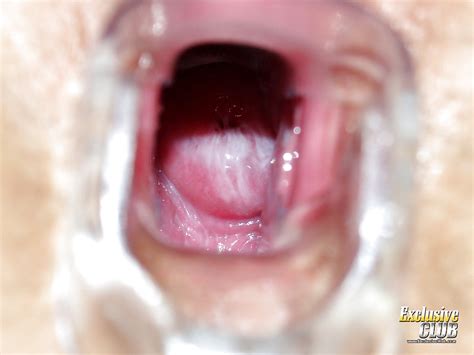 Fetish Girl In Glasses Gives Her Hairy Pussy For A Look To Gyno Doc Porn Pictures XXX Photos