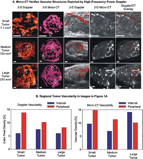 Power Doppler Ultrasound Images Of Vasculature In A Gem Prostate Cancer