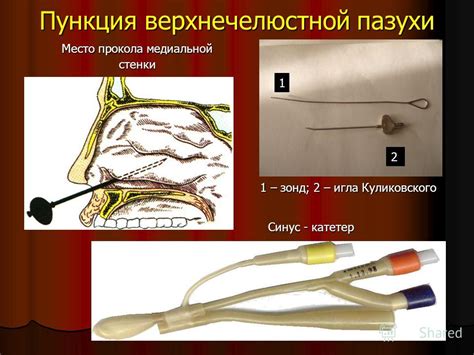 Презентация на тему: "Гайморит Классификация гайморита В зависимости от ...