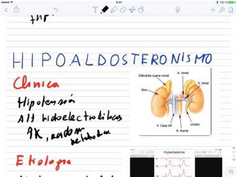 Hiperaldosteronismos E Hipoaldosteronismo Youtube