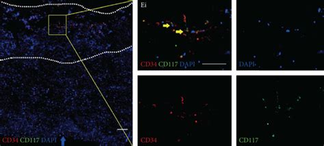 Adventitial Progenitor Cells In HGSV The Red Arrow Indicates