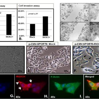 A J Riok Overexpression Promotes Cell Migration Invasion And