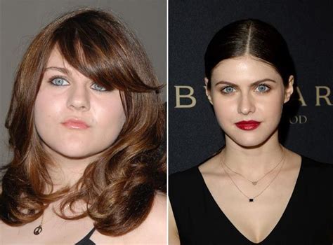 Frances Bean Cobain Plastic Surgery Before After Bad Celebrity