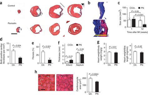 Periostin Reduces Scar Formation And Attenuates Post Infarct