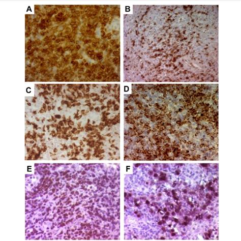 Immunohistochemistry Conditions And Evaluation Download Scientific