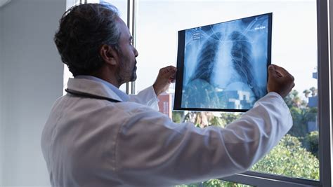 Some Patients Fear Lung Cancer Screenings Heres Why They Shouldnt