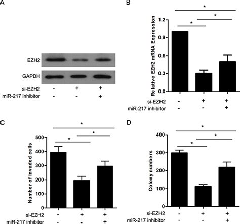 Microrna 217 Inhibits Tumor Progression And Metastasis By