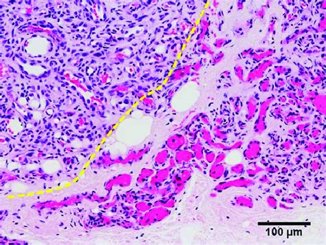 Histopathological Findings Hematoxylin Eosin Staining The Left Side