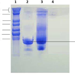 Sodium Dodecyl Sulphate Polyacrylamide Gel Electrophoresis Sds Page