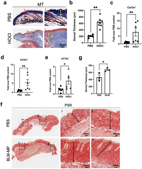 HOCl Injections Induce Local Skin Fibrosis Whereas BLM Administration